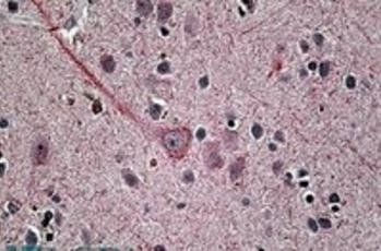 Goat anti-Synaptotagmin I Antibody