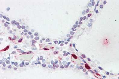 Goat anti-ATP13A1 Antibody