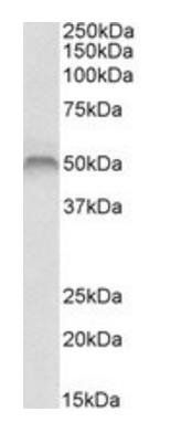 FSCN1 Antibody