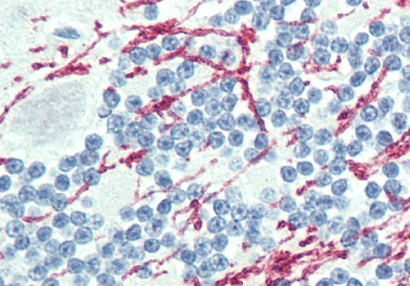 GCH1 antibody