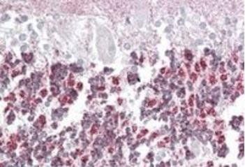 Laforin (isoform a) Antibody