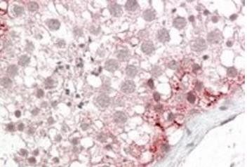Goat anti-ABCD3 Antibody