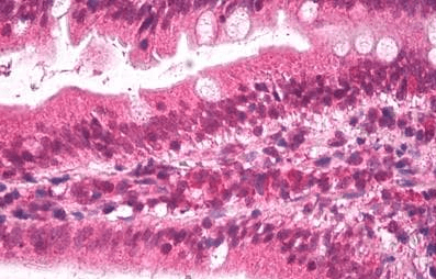 Goat anti-APOB Antibody