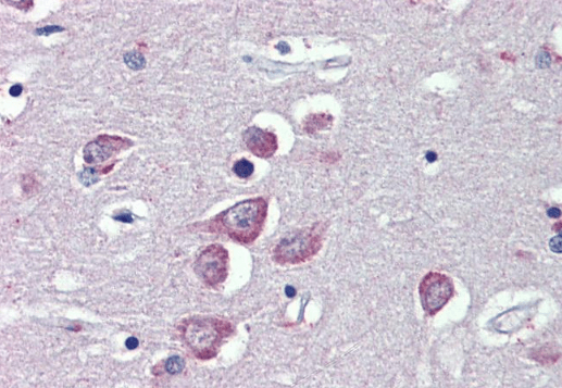 Goat anti-TRPM2 Antibody