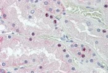 Goat anti-HOXD10 Antibody