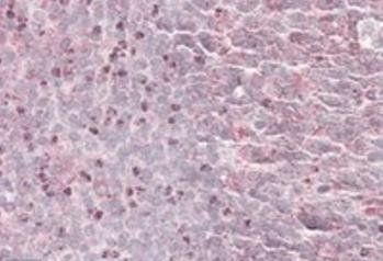 Goat anti-SEPT6 Antibody