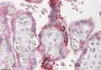 Goat anti-NCE2 / UBE2F Antibody