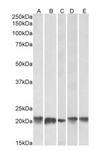 Ferritin antibody