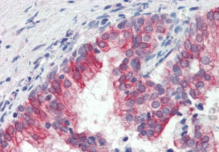 Goat anti-ROR1 Antibody
