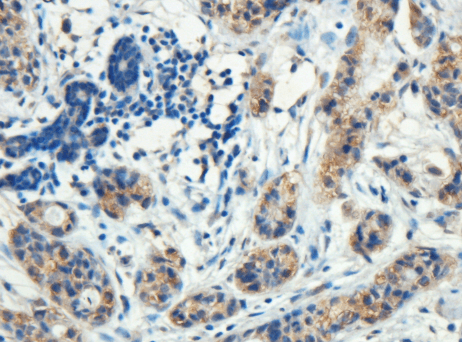 Goat anti-ROR1 Antibody