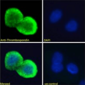 Goat anti-Thrombospondin Antibody