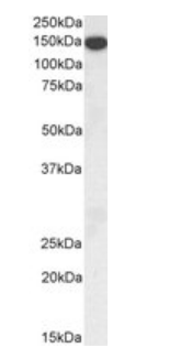Goat anti-Thrombospondin Antibody