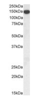 THBS1 antibody