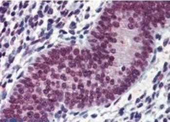 Goat anti-EWS / EWSR1 Antibody
