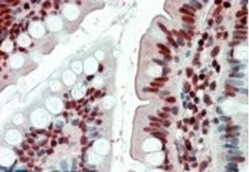 Goat anti-EWS / EWSR1 Antibody