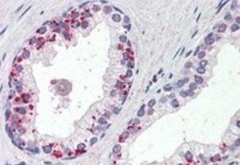 Goat anti-Annexin I Antibody
