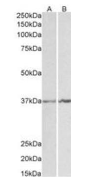 Goat anti-Annexin I Antibody