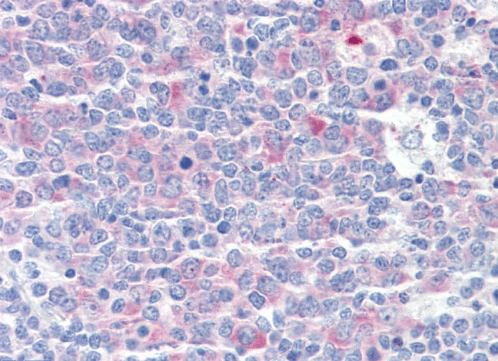 Goat anti-CCT3 / TCP1 Antibody