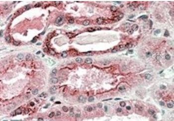 Goat anti-GGCX Antibody