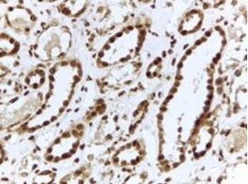 ILF3 Antibody
