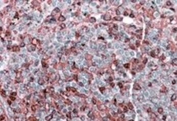 Goat anti-NFATC2 / NFAT1 Antibody