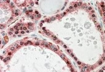 Goat anti-KCNN2 Antibody