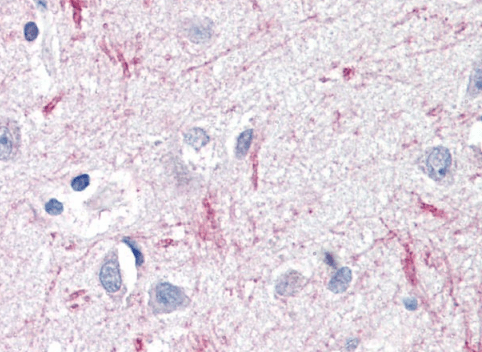 Goat anti-DTX3 Antibody