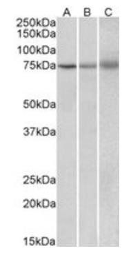 Goat anti-KLHL6 / Kelch-like 6 Antibody