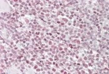 Goat anti-IKAROS / IKZF1 Antibody