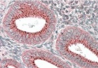 Goat anti-SNX1 Antibody