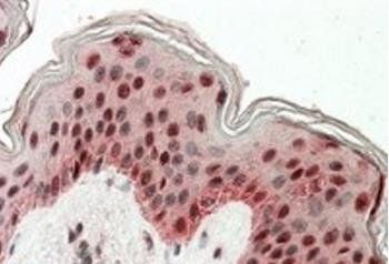 Goat anti-TIAL1 & TIA Antibody