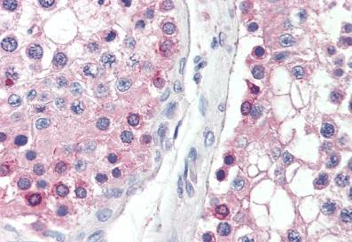 DYDC1 (aa142-154) Antibody