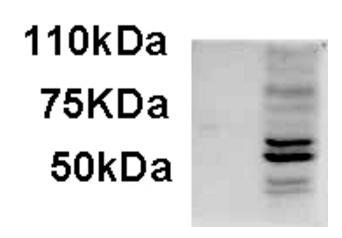 Goat anti-AIM2 Antibody