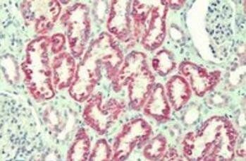 Goat anti-ANTXR2 / CMG2 Antibody