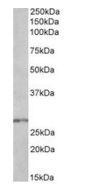 HOXB9 Antibody