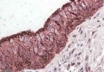Goat anti-ALDH3A1 Antibody