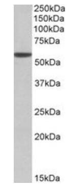 Goat anti-ALDH3A1 Antibody
