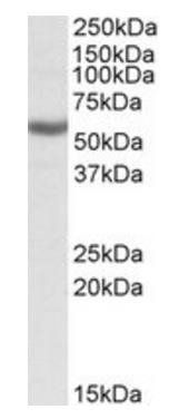 ALDH3B1 Antibody