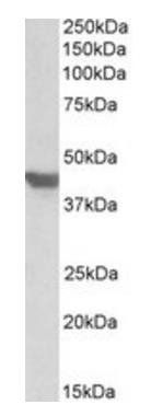 Goat anti-SLC2A4 / GLUT4 Antibody