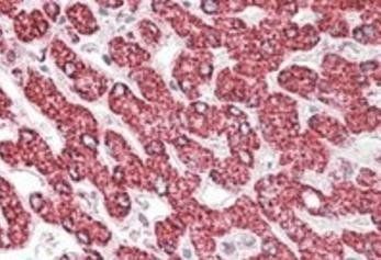 Goat anti-ETFB / FP585 (aa 152-165) Antibody