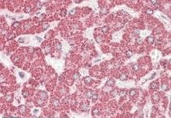 Goat anti-ETFB (aa 231-243) Antibody
