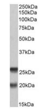 SNAP23 (aa 135-144) Antibody