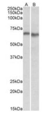 PRKAA2 Antibody