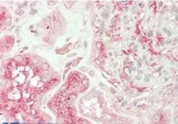 Unc13b (mouse) Antibody