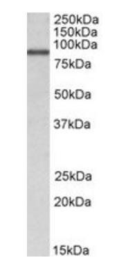 ALDH18A1 Antibody