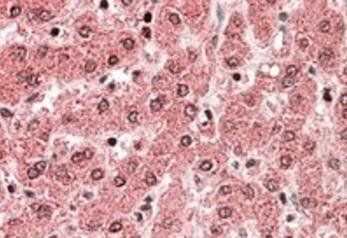 Goat anti-ALDH5A1 (aa 485-496) Antibody