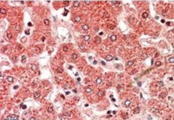Goat anti-ALDH6A1 (aa487-496) Antibody