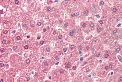 ALDH6A1 (aa262-272) Antibody