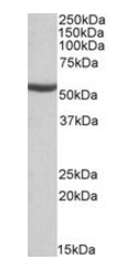 ALDH6A1 (aa262-272) Antibody