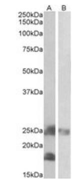 Goat anti-DCTN3 Antibody